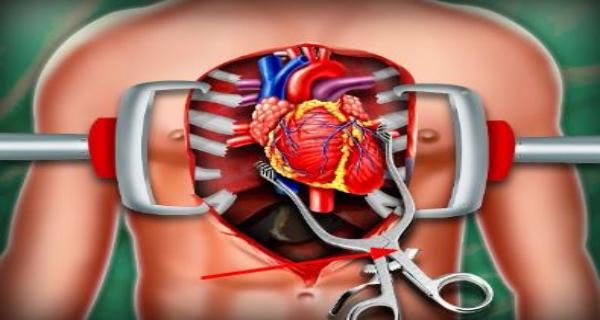 心臟手術(shù)模擬器 v2.4 安卓版 0