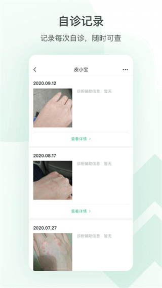 皮小寶皮膚管理 v2.2.1 安卓版 1